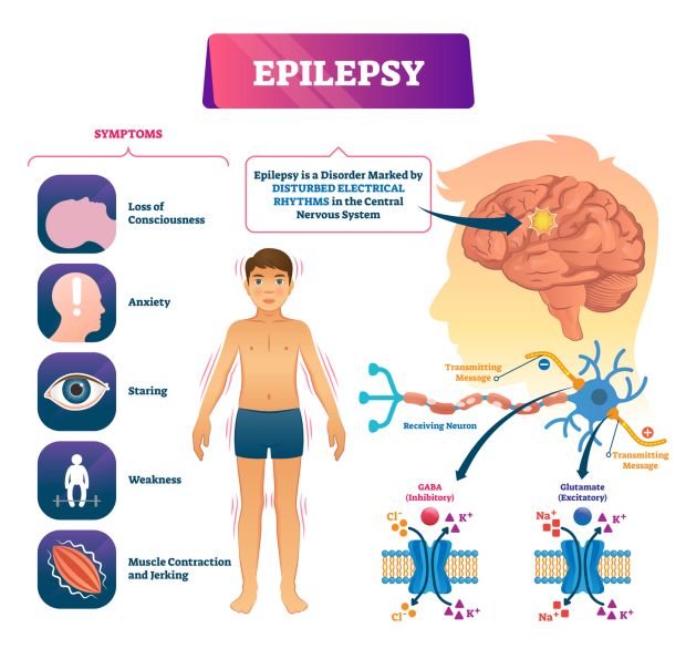 epilepsy