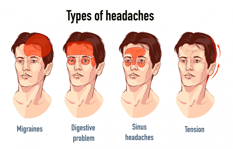 headache